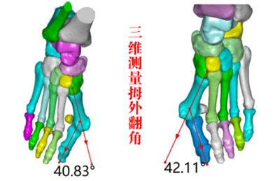 3d“导航”,精雕细琢“脚拐”归位1762.png 3d“导航”,精雕细琢“脚拐”归位1762.png
