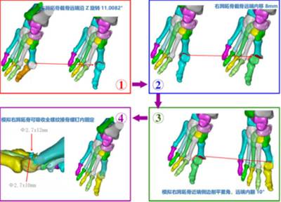 3d“导航”,精雕细琢“脚拐”归位1812.png 3d“导航”,精雕细琢“脚拐”归位1812.png