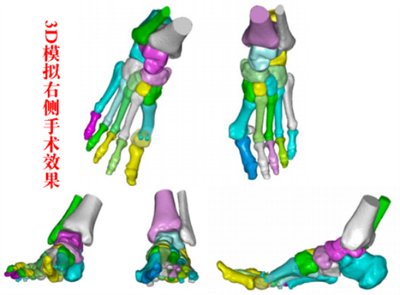 3d“导航”,精雕细琢“脚拐”归位1835.png 3d“导航”,精雕细琢“脚拐”归位1835.png