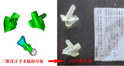 3d“导航”,精雕细琢“脚拐”归位1849.png 3d“导航”,精雕细琢“脚拐”归位1849.png