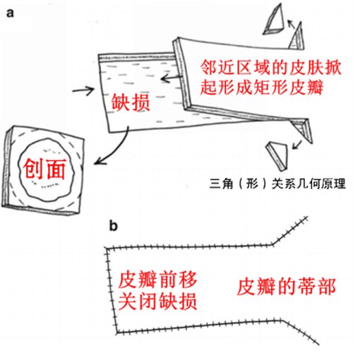 前额溃烂“巧修补” 百岁老人“焕新颜”1333.png 前额溃烂“巧修补” 百岁老人“焕新颜”1333.png