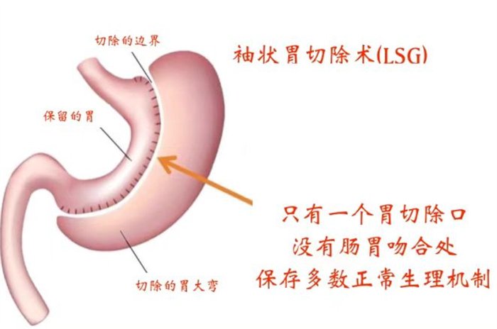 图片5.png 图片5.png