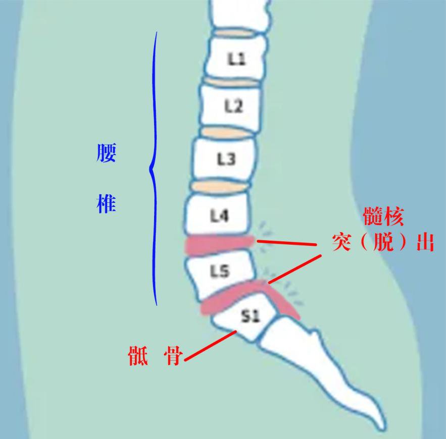图片18.png 图片18.png