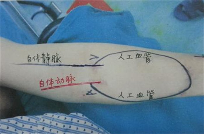 图片8.png 图片8.png