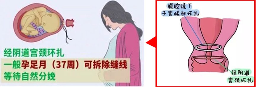 640 (3).png 640 (3).png