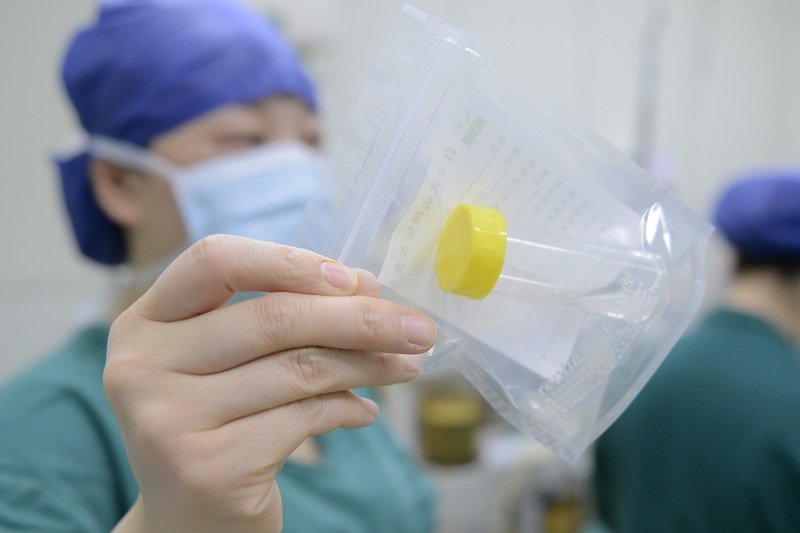 支气管镜下冲洗、抽吸出的肺内分泌标本.JPG 支气管镜下冲洗、抽吸出的肺内分泌标本.JPG