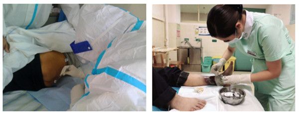 全君洁为患者处理伤口、换药.jpg 全君洁为患者处理伤口、换药.jpg