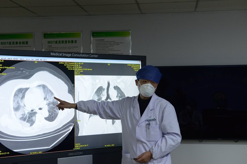 习建冬就患者CT片结果发表诊治意见.JPG 习建冬就患者CT片结果发表诊治意见.JPG