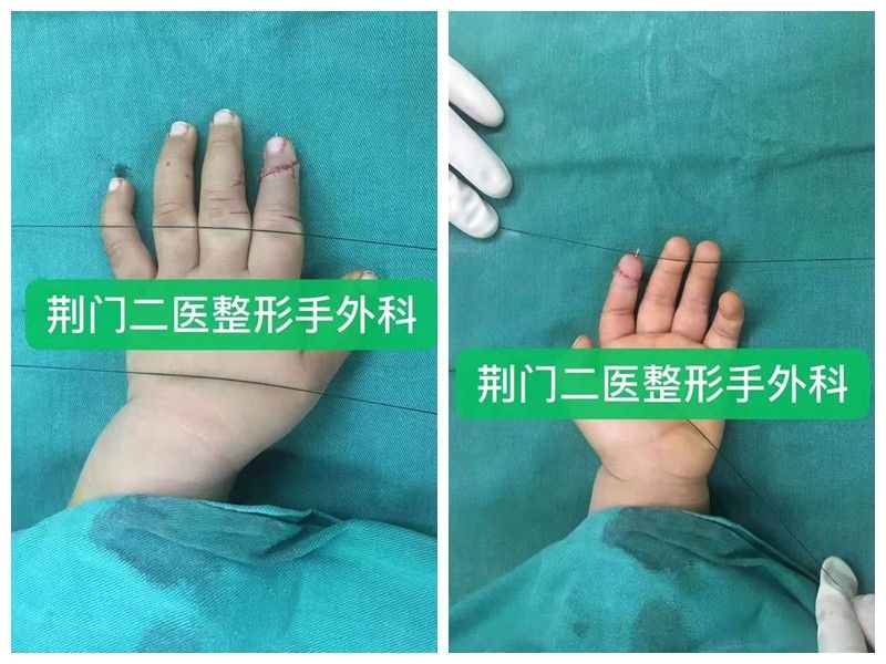 NeoImage_副本_副本_副本.jpg NeoImage_副本_副本_副本.jpg