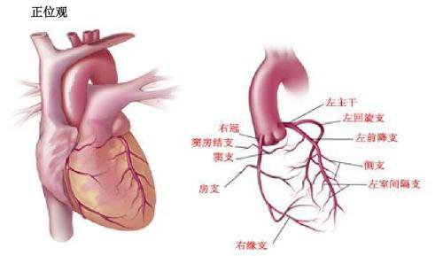 心脏血管3D效果图.png 心脏血管3D效果图.png