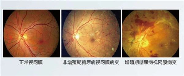 图片11.jpg 图片11.jpg