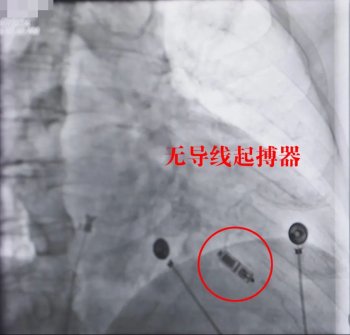 图片4.png 图片4.png