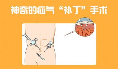 图片 14.png