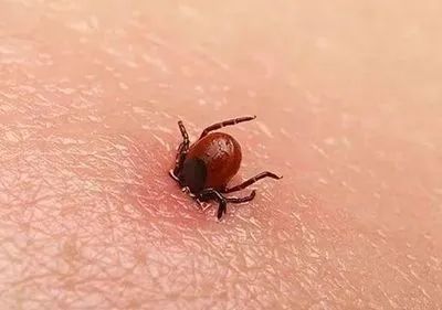 “蜱虫病”有多危险?